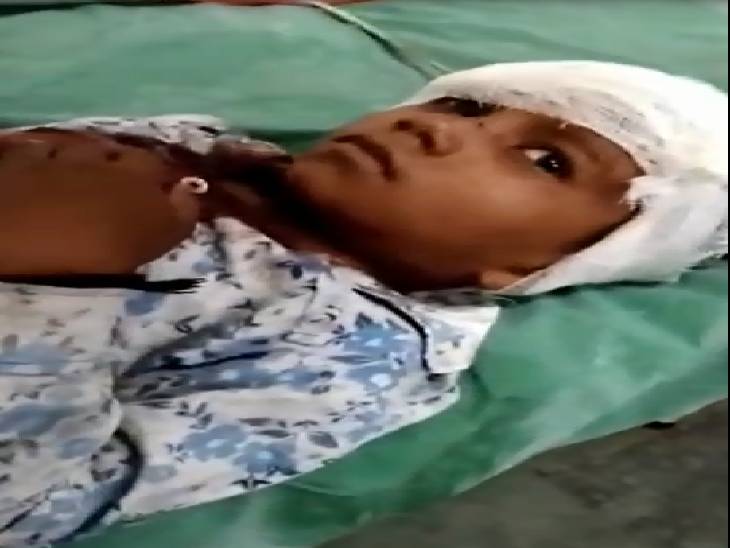 हर्ष फायरिंग में पांच मासूमों को लगी गोली, दो की हालत गंभीर