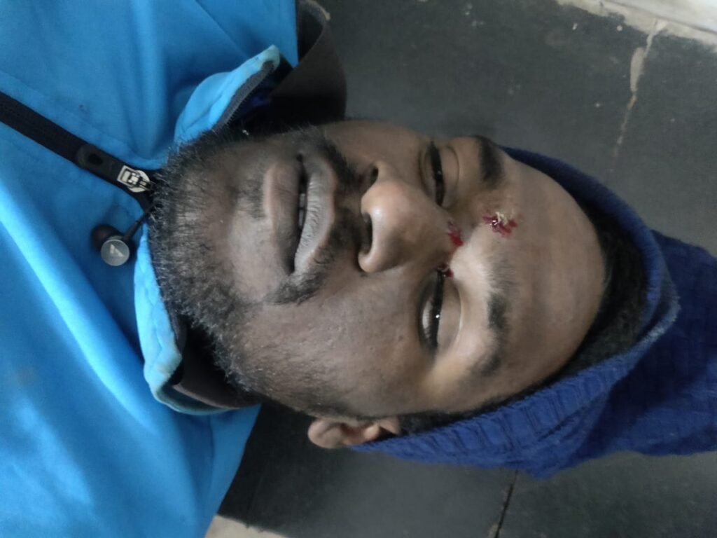 बीजेपी प्रत्याशी विनोद सिंह पर हमला