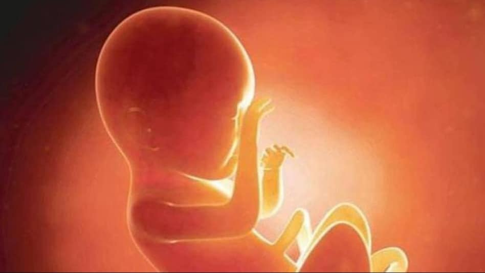 गर्भपात का संवैधानिक अधिकार खत्म, सुप्रीम कोर्ट