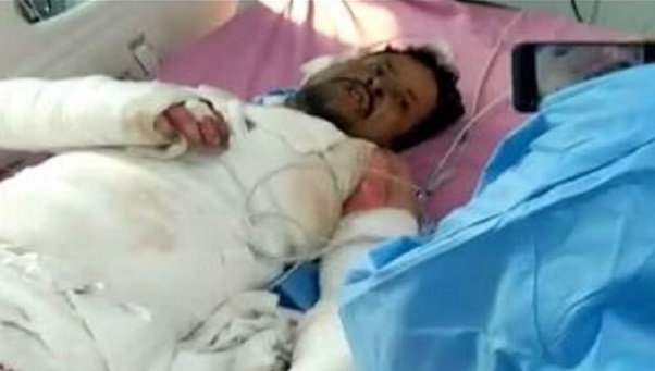 ससुराल वालों ने दामाद को पेट्रोल डालकर किया आग के हवाले… दामाद की दौलत पर थी ससुराल वालों की