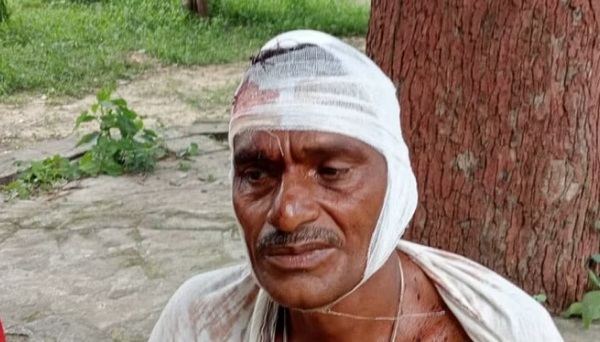 दो पक्षों में जमकर चले लाठी-डंडे, खूनी संघर्ष में डेढ़ दर्जन लोग घायल