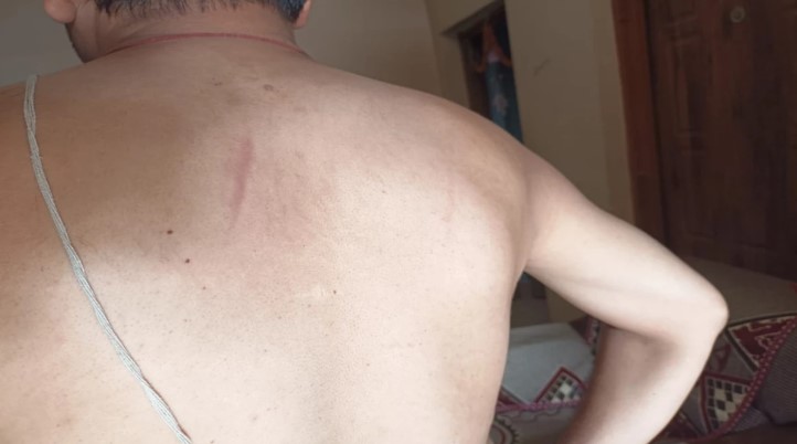 छत्तीसगढ़ में प्रभारी तहसीलदार के साथ पुलिस ने की मारपीट, घर वाले बोले- ‘अब बाहर निकलने से भी डर लगता है’