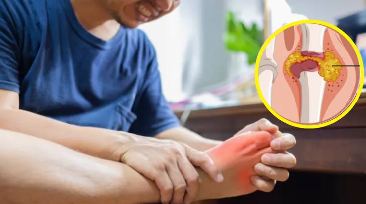 इस ड्रिंक को पीने से पेशाब के साथ बाहर आ जाएगा Uric Acid, सेलिब्रिटी न्यूट्रिशनिस्ट ने बताया बनाने का तरीका