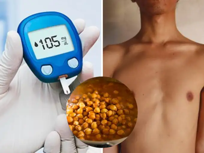 पाचन पड़ेगा ठप, शरीर बनेगा सूखा कांटा, ताकत के लिए 5 चीजें खाएं डायबिटीज रोगी, Sugar भी कंट्रोल