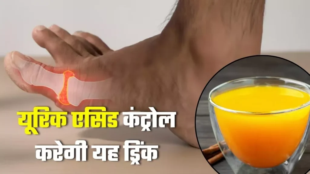 शरीर में बढ़ गया है यूरिक एसिड, तो घबराएं नहीं! डॉक्टर के बताए इस एक ड्रिंक से नेचुरली होगा कंट्रोल