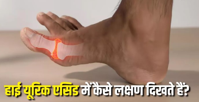 सिर्फ रात में दिखाई देते हैं यूरिक एसिड बढ़ने के ये 4 लक्षण, दिखते ही शुरू कर दें 5 काम