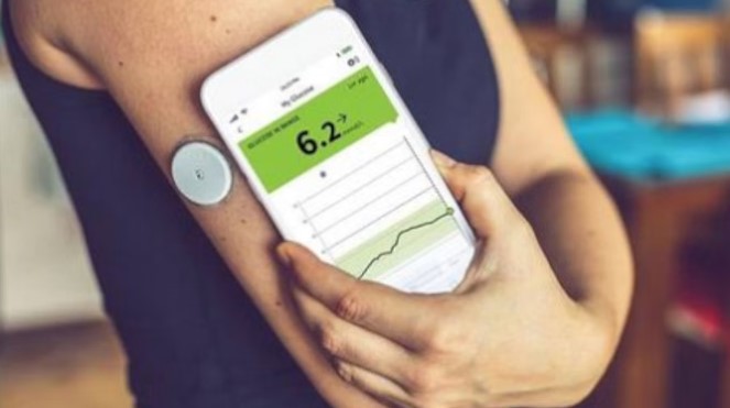 अब बांह में लगी माइक्रोचिप करेगी शुगर कंट्रोल, ऑनलाइन निगरानी करेंगे डॉक्टर; इतनी है मॉनिटर पैच की कीमत